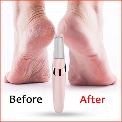 Callus Remover At-home Pedicure