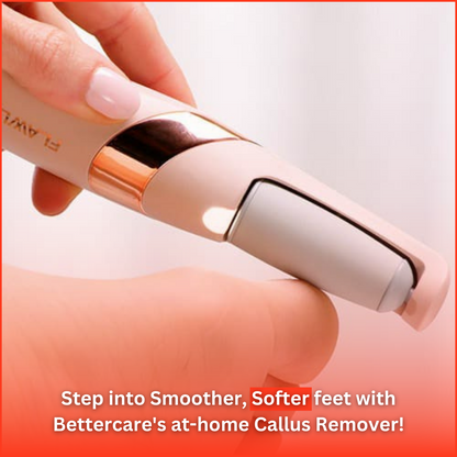 Callus Remover At-home Pedicure